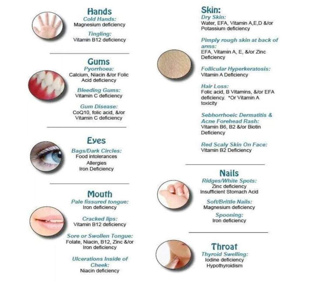 What Are The Common Symptoms Of Vitamin Deficiencies