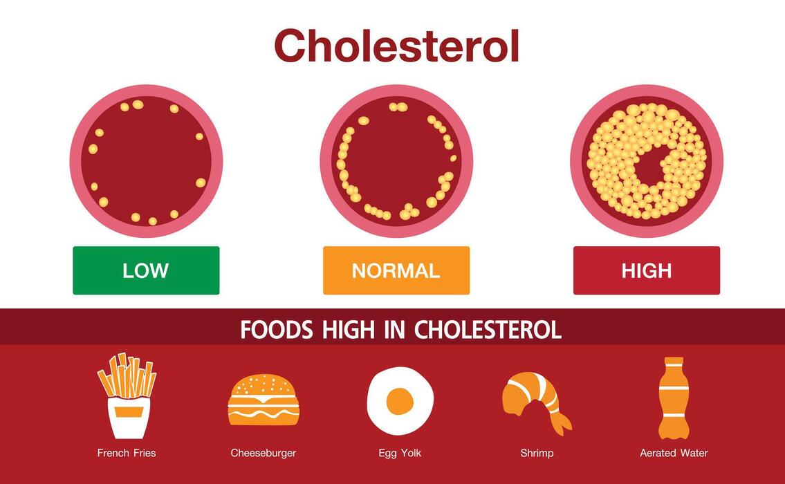High Cholesterol Vector Art, Icons, and Graphics for Free Download How To Boost Immune System Naturally With Diet?